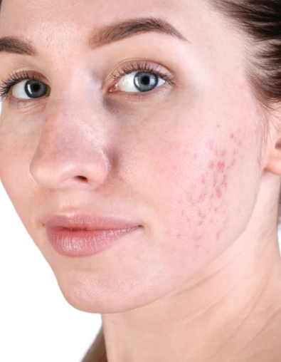 face mask for clear glowing skin
