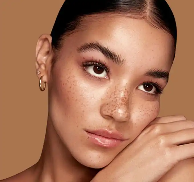 Close-up portrait of a woman with freckles on a brown background, neutral expression—good for product or clinical pages